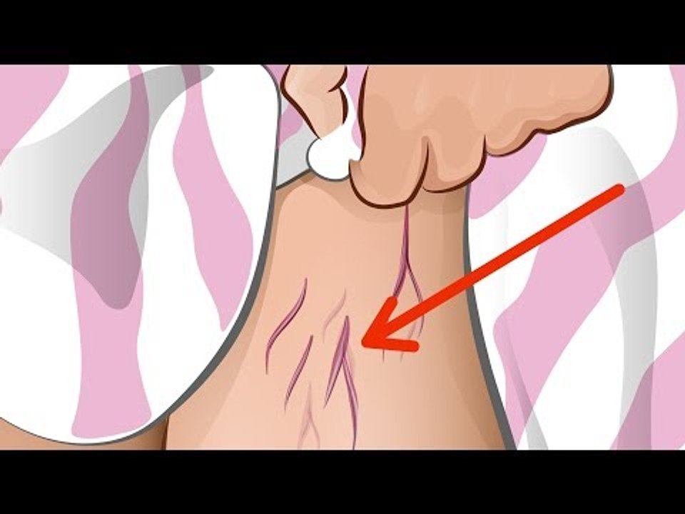 Wenn du diese Symptome hast, ist dein Leben in Gefahr!