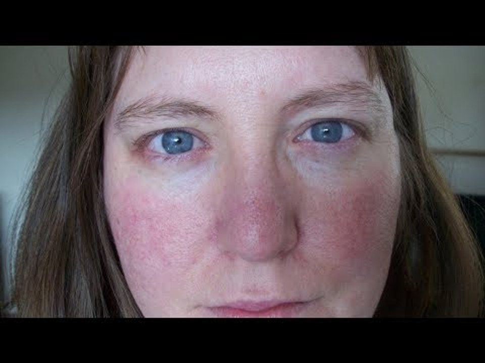 8 genetische Mutationen, die viele für normal halten.