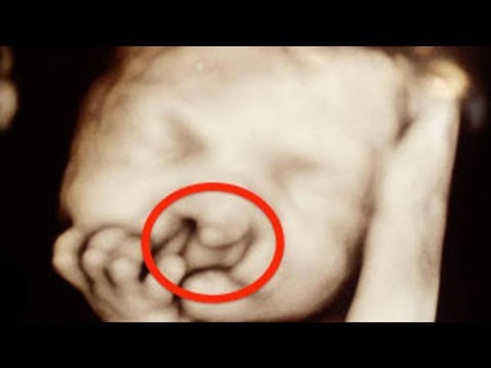 Diesen Zettel steckt man dem Baby mit Geburtsfehler im Restaurant zu. Die Mutter ist sprachlos!