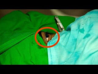 Die Mutter entfernt vor ihrem Sohn den Verband. Da kom...