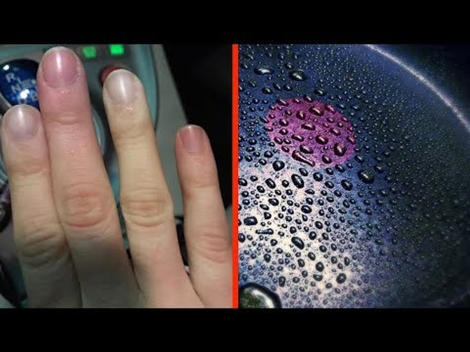 Frau mit Krebs warnt eindringlich vor der Gefahr diese...