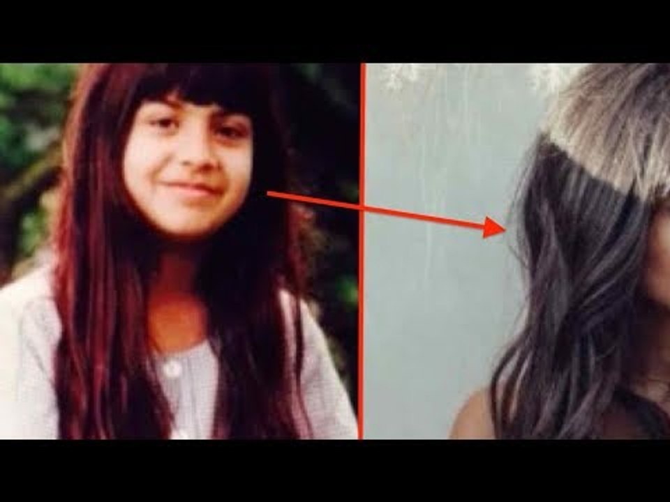 Das Mädchen wird von einem Auto erfasst. So sieht sie heute aus.