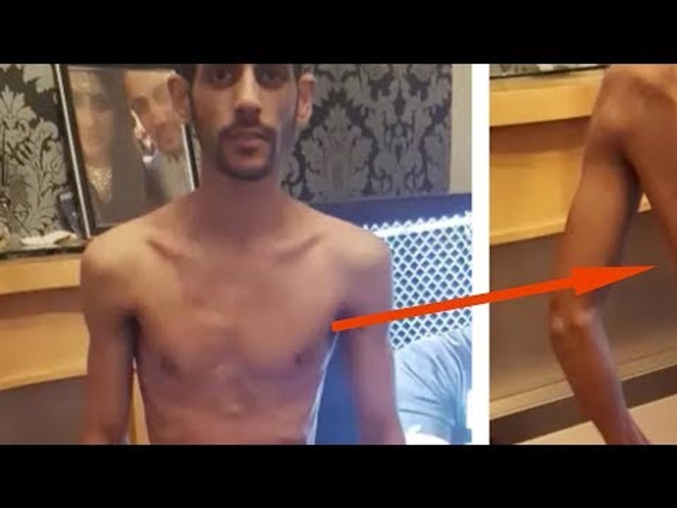 Er besteht nur noch aus Knochen. Jahre später erkennt ihn niemand mehr wieder.