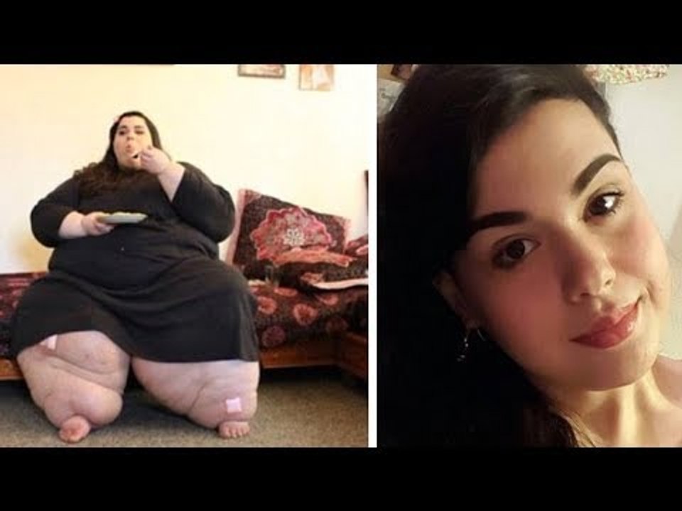 1 Jahr nach der OP geht sie zum Arzt. Ihm fallen die A...