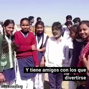 Lalit Patidar, un niño que padece el extraño síndrome del 'hombre lobo'