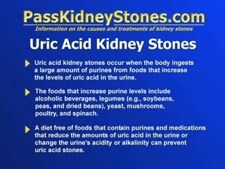 Uric Acid Kidney Stones