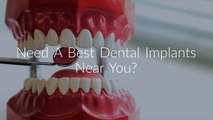 America Dental Clinic: Dental Implants Near You