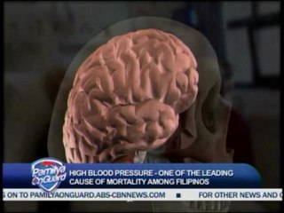pamilyaonguard-HIGH BLOOD PRESSURE NOW A SERIOUS CONCERN