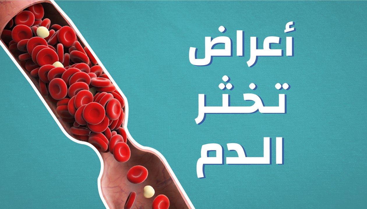 أعراض تخثر الدم