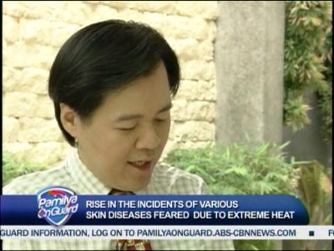 pamilyaonguard-BEWARE OF BOILS AND PRICKLY HEAT THIS SUMMER