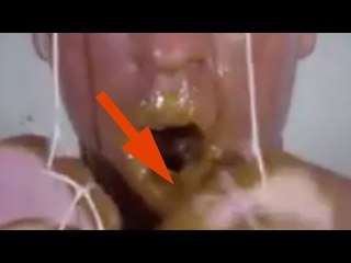 What Happens To This Man's Face, Shocks Ma...