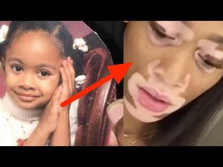 What Doctors Discovered About The Girl Made Her A Star 15 Years Later