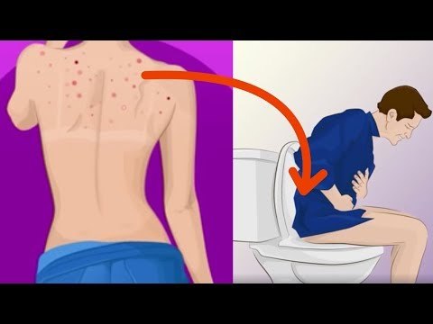 Voilà ce que révèlent les boutons sur votre corps. Impressionnant !