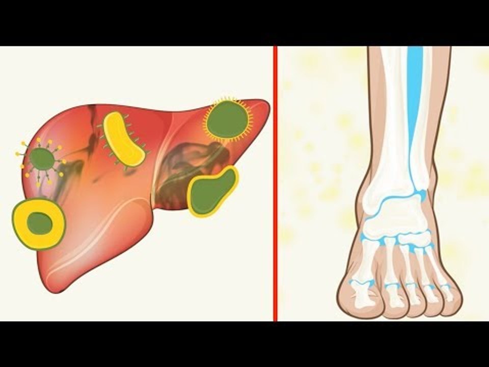 This Is What Happens When You Drink Hot Lemon Water For 8 Weeks