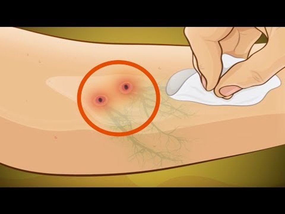 If THIS Happens To You, You Cannot Make THESE Mistakes!