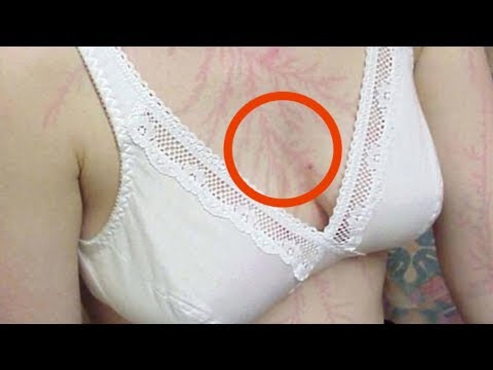 Parece uma tatuagem, mas isso quase a...
