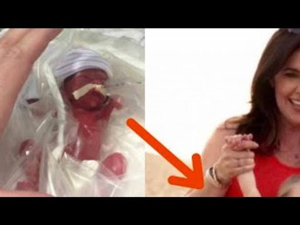Os médicos ficaram sem ar ao ver este bebê pela primeira vez.