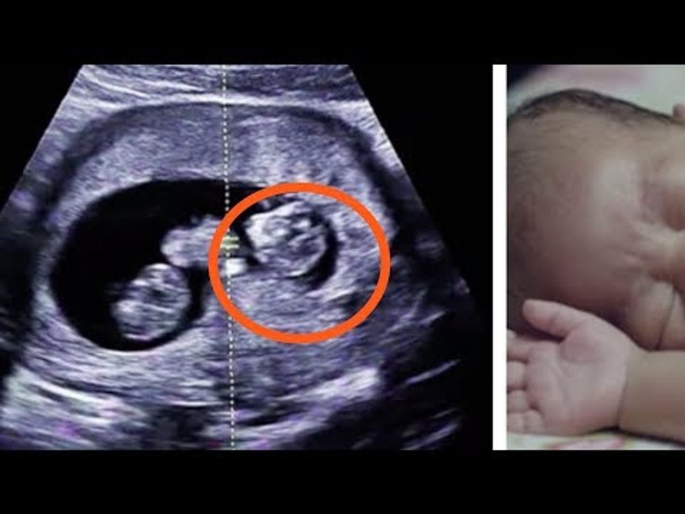 Elle trompe son mari. À la naissance de leurs enfants, il tombe de très haut !