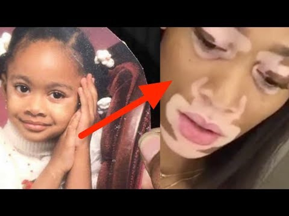 Ce que les médecins découvrent chez cette fillette fait d'elle une star 15 ans plus tard.