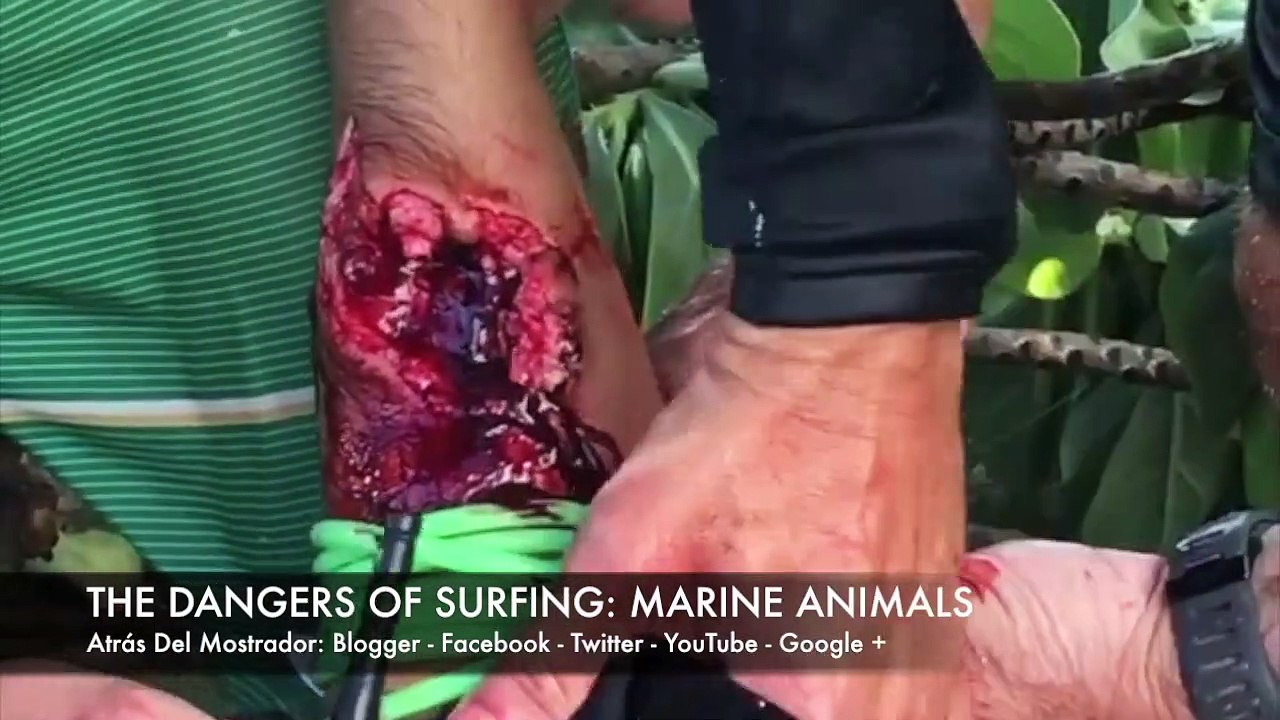 the dangers of surfing - HD 720p