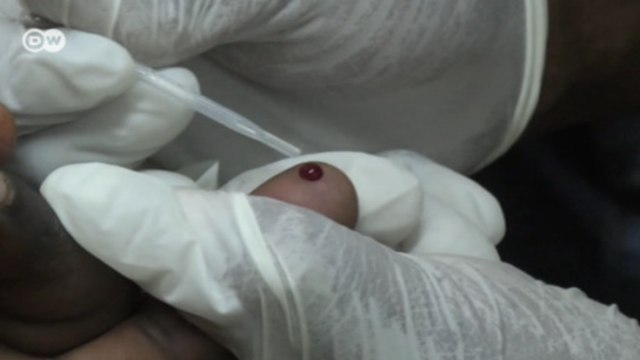 مكافحة السيدا في جنوب إفريقيا