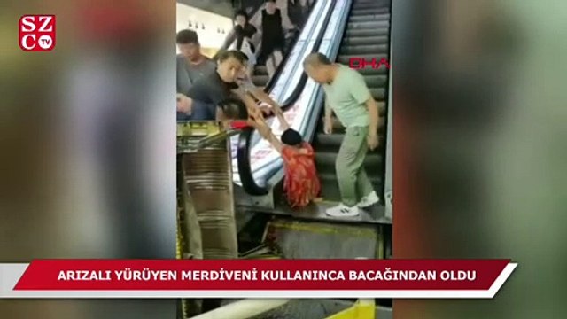 Arızalı yürüyen merdiveni kullandı, sol bacağından oldu