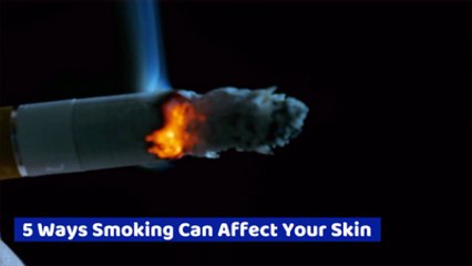 Your Skin Gets Ruined When You Smoke