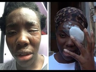 L'agression de l'athlète Daisy Osakue choque l'Italie