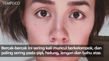Agnes Mo Tampil Tanpa Make Up, Perlihatkan Freckles di Hidung
