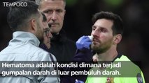 Liga Champions: Cedera Messi Warnai Kemenangan Barcelona Vs MU