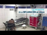 Hepatitis, enfermedad que afecta a millones de mexicanos, un reportaje de El Heraldo TV