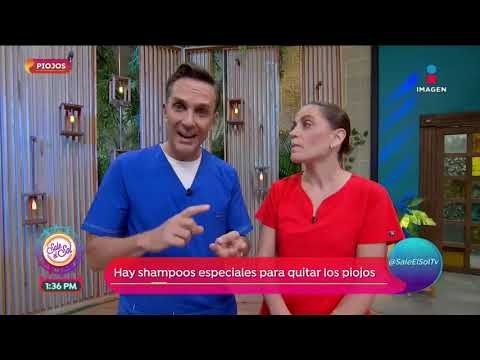 Visita de doctor: ¿Cómo reconocer y deshacerte de los piojos? | Sale el Sol