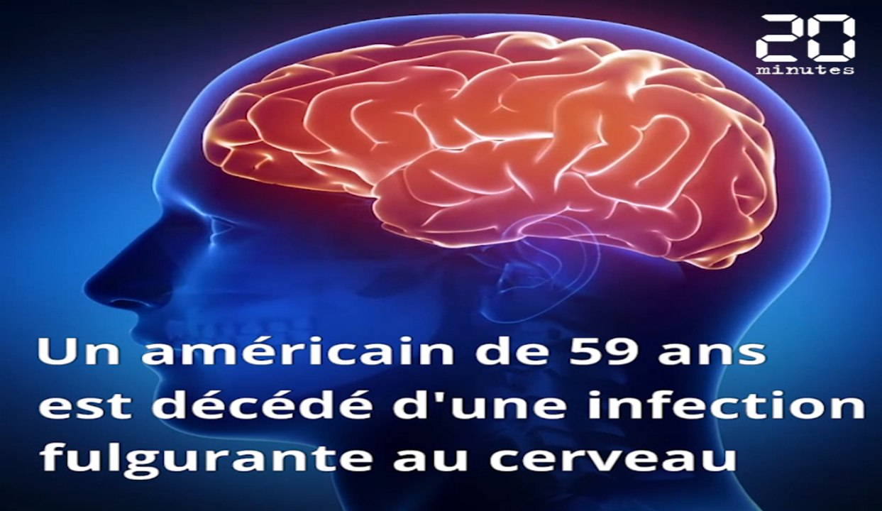 Un Américain tué par une amibe «dévoreuse de cerveau»