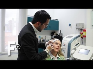 Mi primera vez con la toxina botulínica