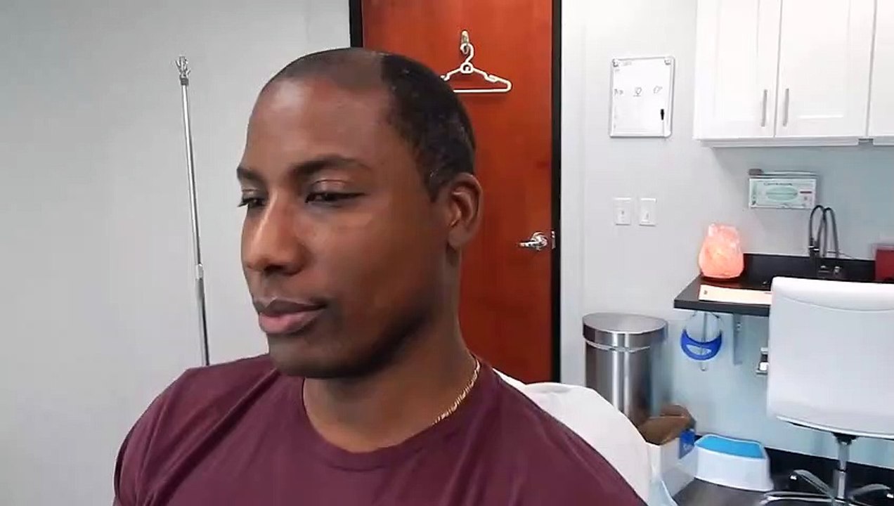 McLean VA Thinning Hair Solutions For Men