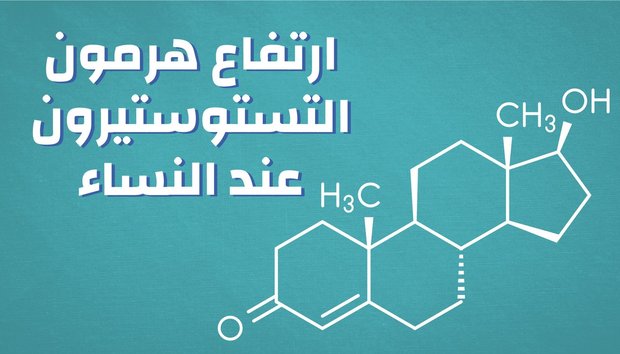 ارتفاع هرمون التستوستيرون عند النساء