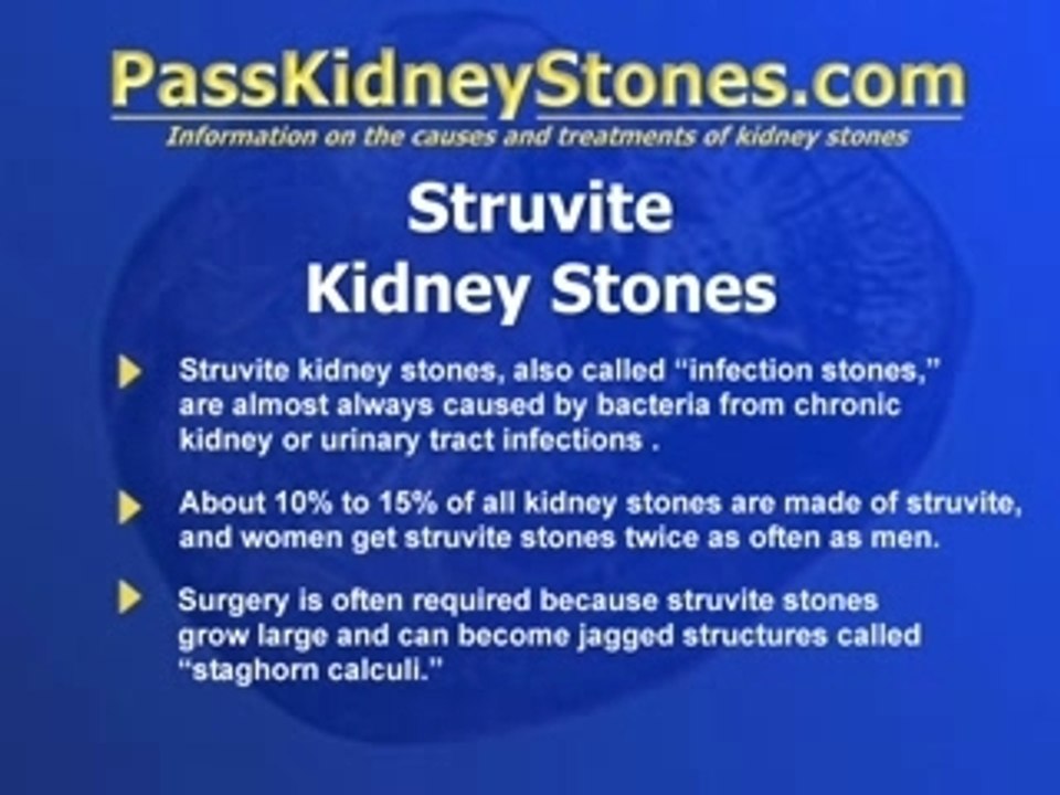 Struvite Kidney Stones