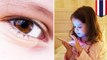 Gadis kecil ini harus operasi mata karena kecanduan smartphone - TomoNews