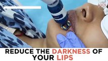 Dark Lips Treatment _ How to Get rid of Dark Lips Forever _ Dr. Nivedita Dadu's Dermatology Clinic