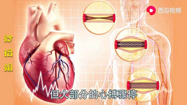 【First aid - cardiopulmonary resuscitation】心肺复苏最详细的操作视频，大家一定要学会，关键时刻能救命