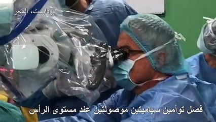 فصل توأمين سياميتين موصولتين عند مستوى الرأس في بنغلادش