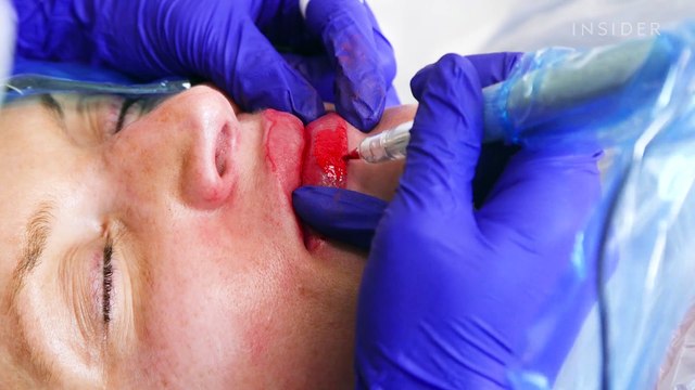 Lip blushing is the new alternative to lip fillers