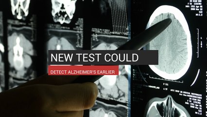 New Test Could Detect Alzheimer's Years Earlier