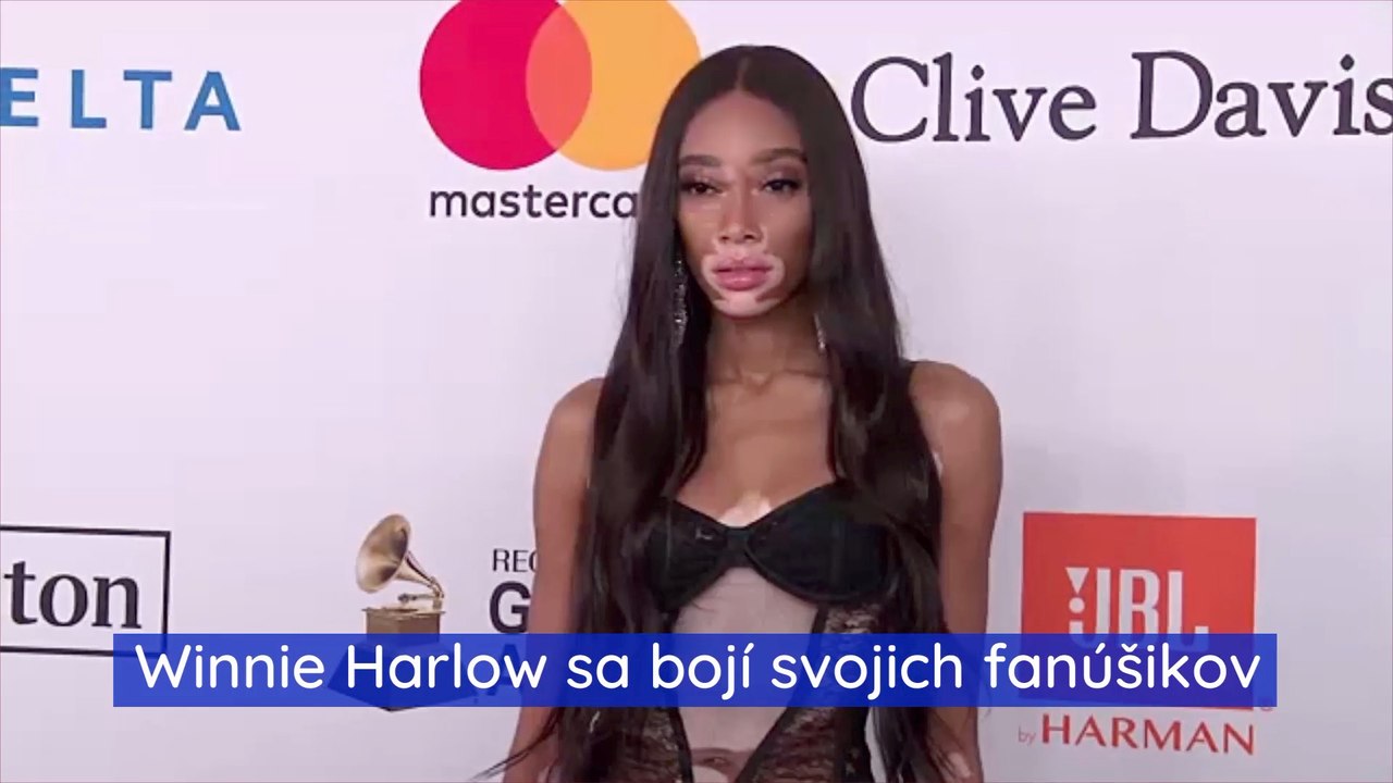 Winnie Harlow sa bojí svojich fanúšikov