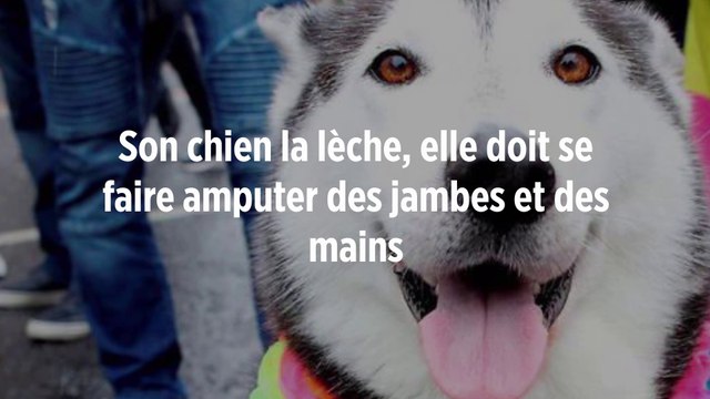 Son chien la lèche, elle doit se faire amputer des jambes et des mains