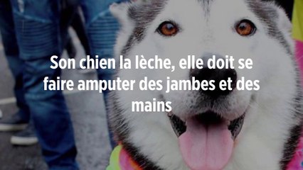 Son chien la lèche, elle doit se faire amputer des jambes et des mains