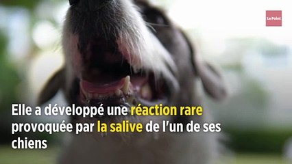 Son chien la lèche, elle doit se faire amputer des jambes et des mains
