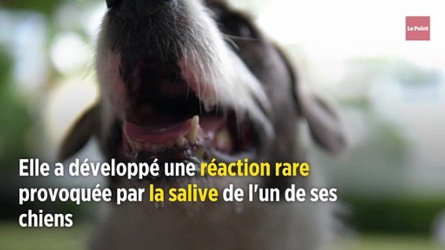 Son chien la lèche, elle doit se faire amputer des jambes et des mains