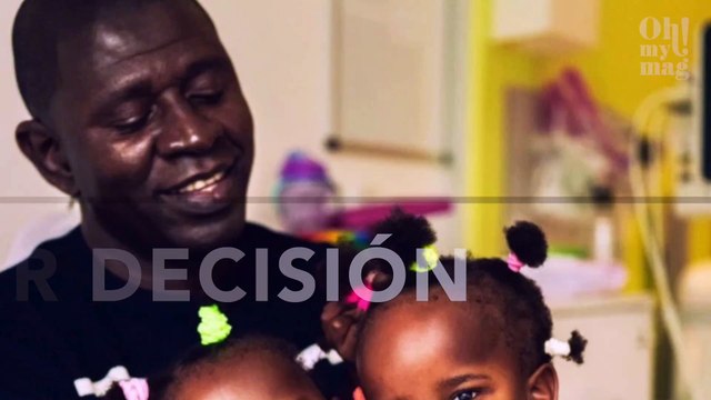 El padre de estas gemelas siamesas debe tomar la peor decisión para salvar a una de ellas