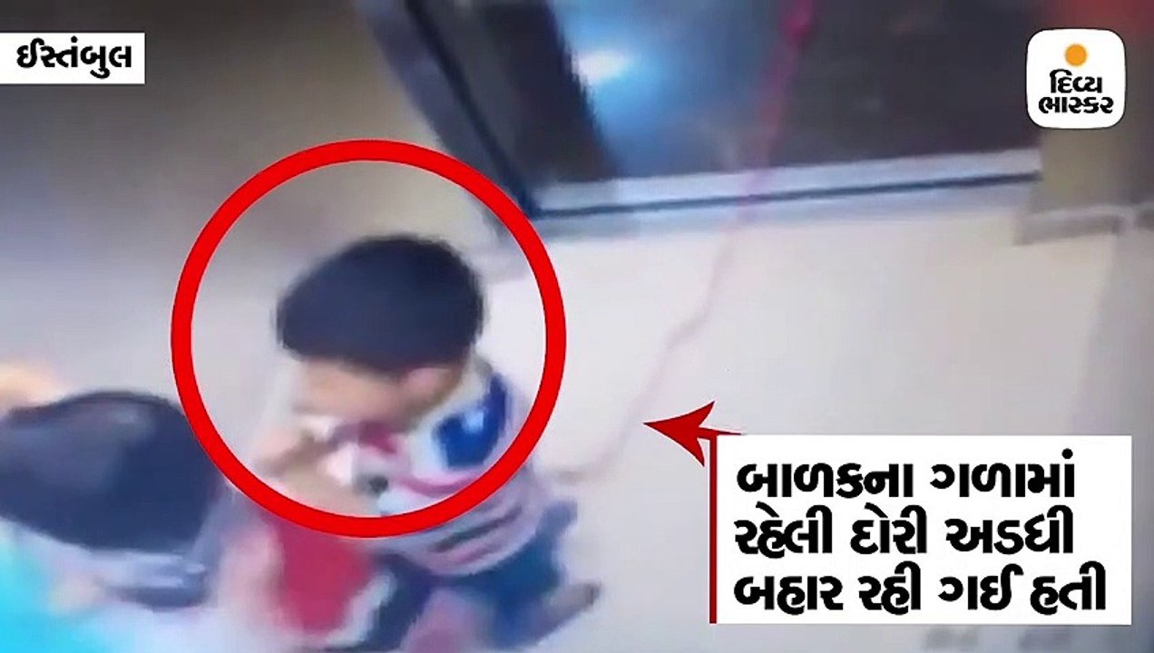 ગળામાં દોરી હોવાથી માસૂમ લિફ્ટમાં લટકી ગયો, 8 વર્ષની બહેને એકલેહાથે બચાવ્યો